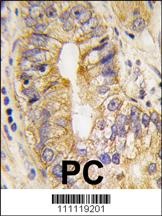 PDGFRA Antibody