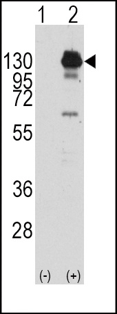 PDGFRA Antibody