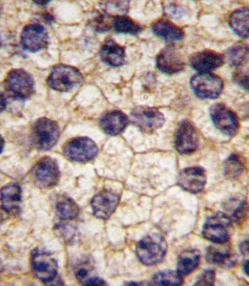 PDGFRA Antibody