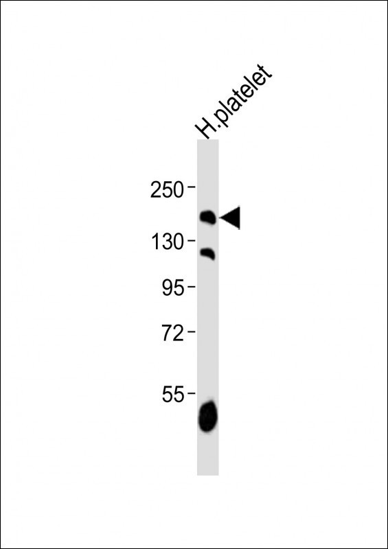 PDGFRA Antibody