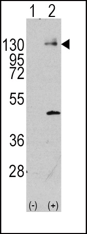 PDGFRA Antibody