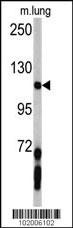 PDGFRA Antibody