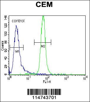 MUSK Antibody