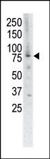 MUSK Antibody