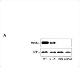 MUSK Antibody