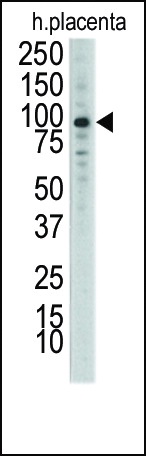 DDR1 Antibody