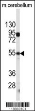 CPE Antibody
