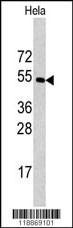 CPE Antibody