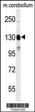 KIT Antibody
