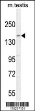 KIT Antibody