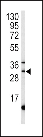 MPST Antibody