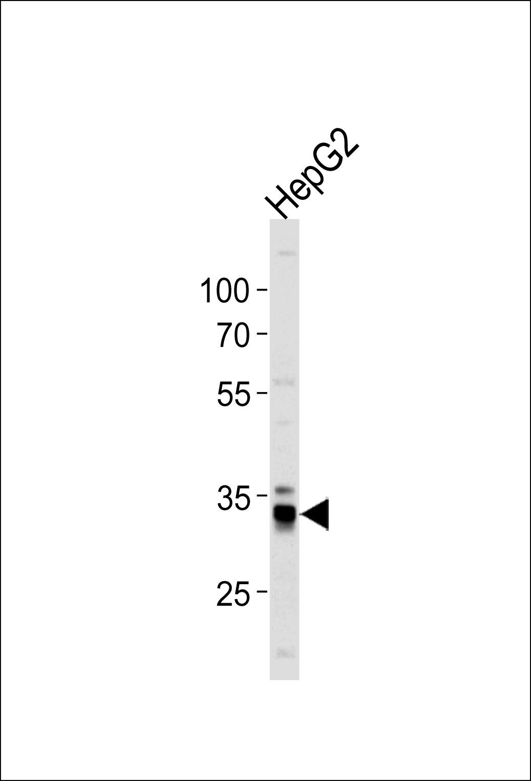 MPST Antibody