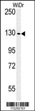 IGF1R Antibody
