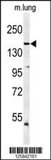 KDR Antibody