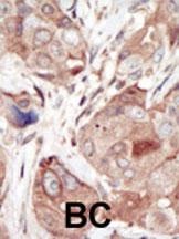 VEGFR2 Antibody