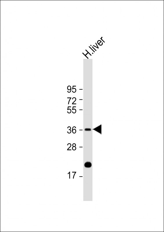 IGFBP3 Antibody