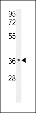 IGFBP3 Antibody