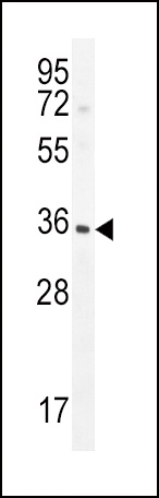 IGFBP3 Antibody