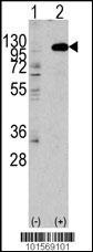 FGFR2 Antibody