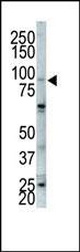 FGFR2 Antibody