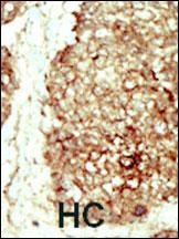 FGFR2 Antibody