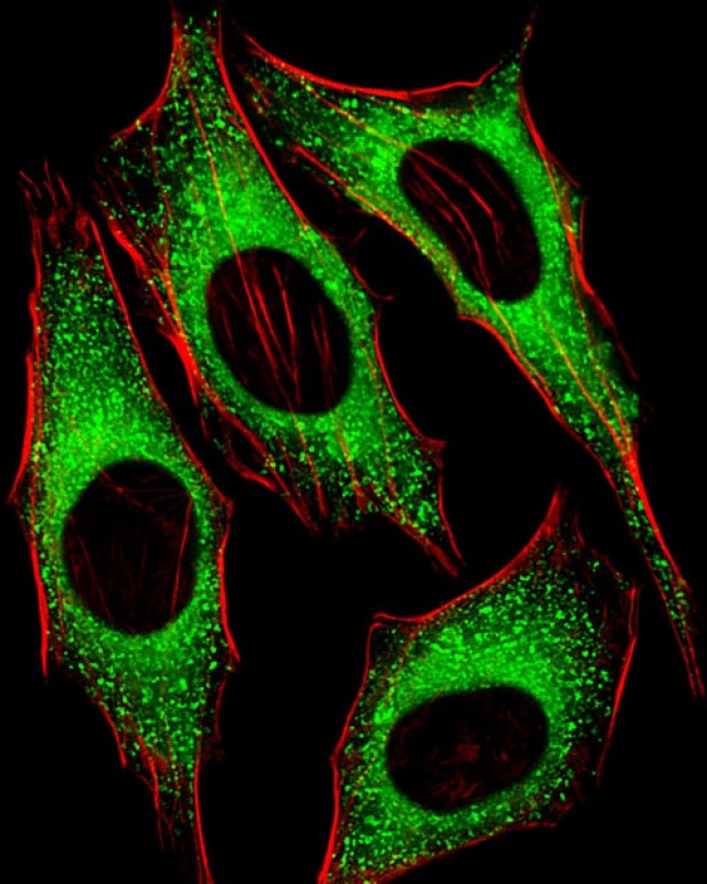 FGFR2 Antibody