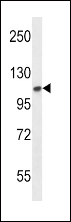 FGFR2 Antibody