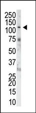 FGFR1 Antibody