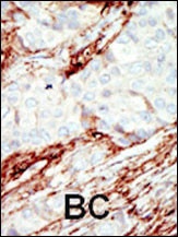 FGFR1 Antibody