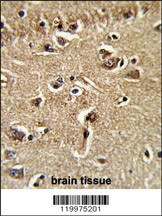 XPOT Antibody