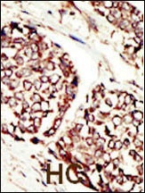 ERBB3 Antibody