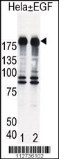EGFR Antibody