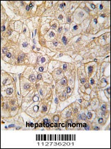 EGFR Antibody