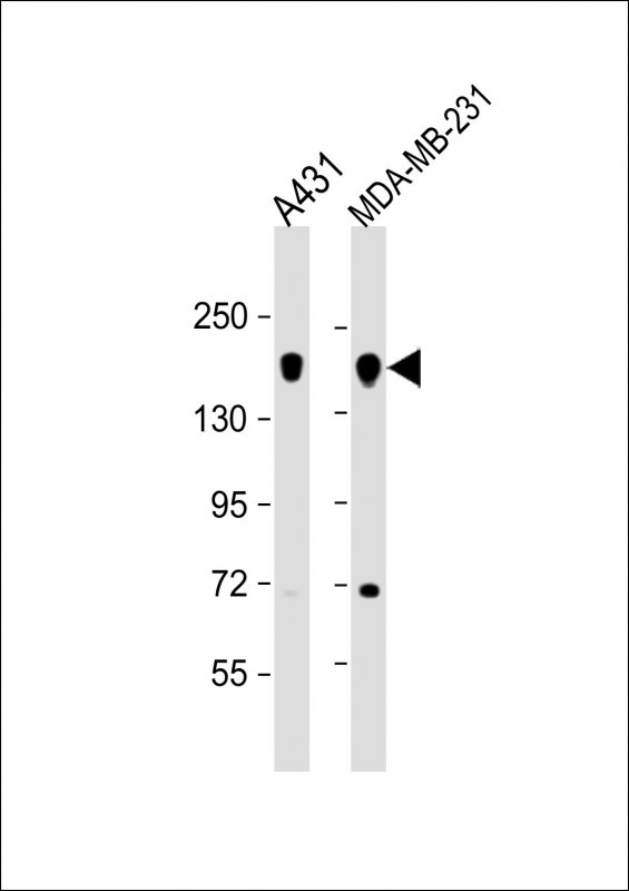 EGFR Antibody