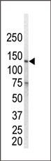 EGFR Antibody