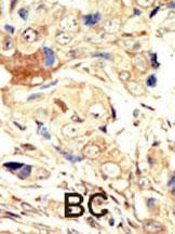 EGFR Antibody