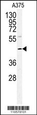 POLDIP2 Antibody