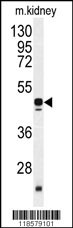 POLDIP2 Antibody