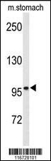 EPHB3 Antibody