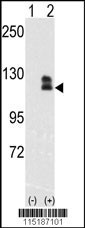 EPHB2 Antibody
