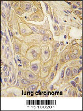 EPHB2 Antibody