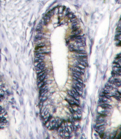 EphB2 Antibody