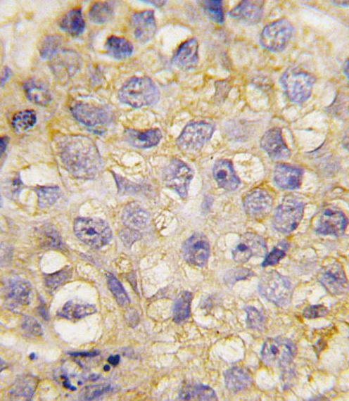 EphB2 Antibody