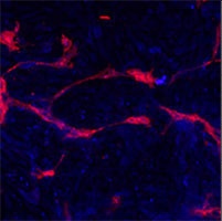 EPHA4 Antibody