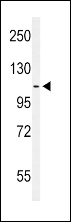 EPHA2 Antibody