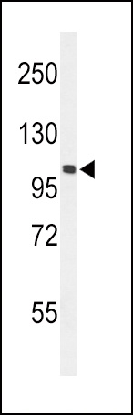 EPHA2 Antibody