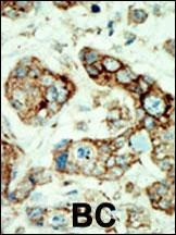 EphA2 Antibody