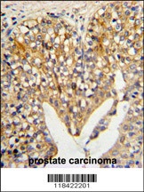 LUM Antibody