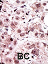 AXL Antibody