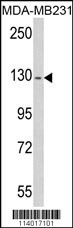 RASGRF1 Antibody